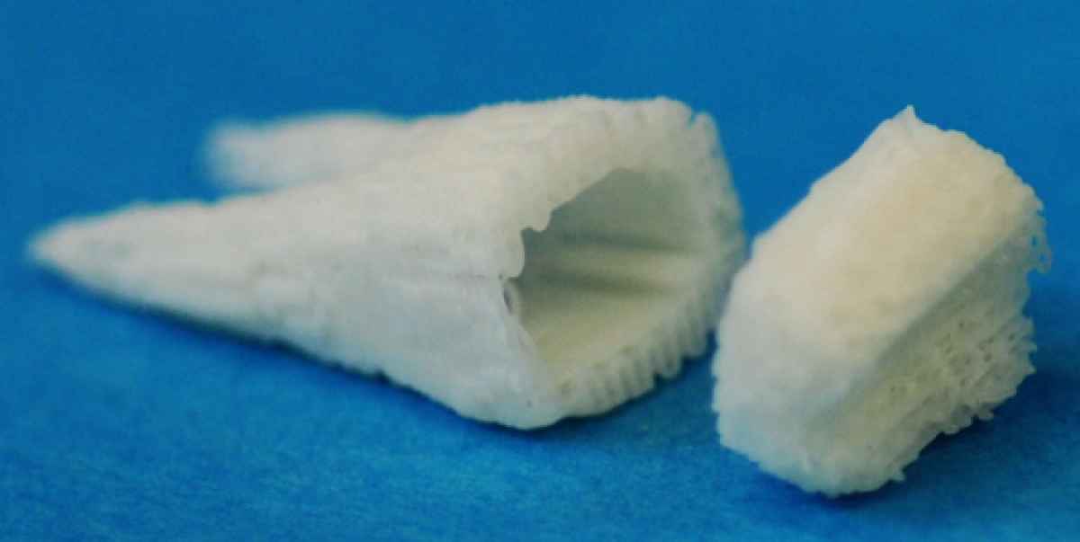 Human Molar Scaffold dental implants FI