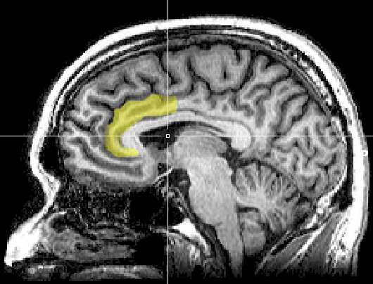 The anterior cingulate cortex, where empathy is processed.