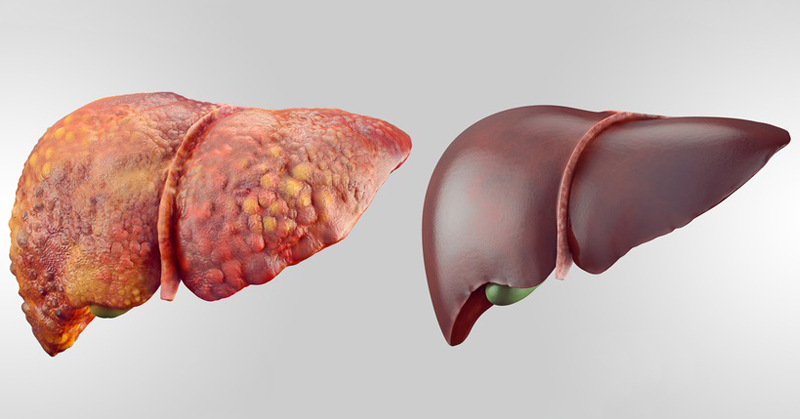 liver detox FI
