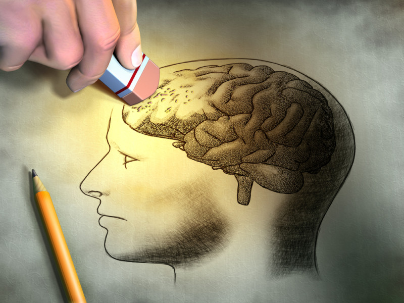 brain diagnose Alzheimer's disease