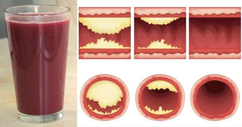 delicious juice pomegranate unclog arteries FI
