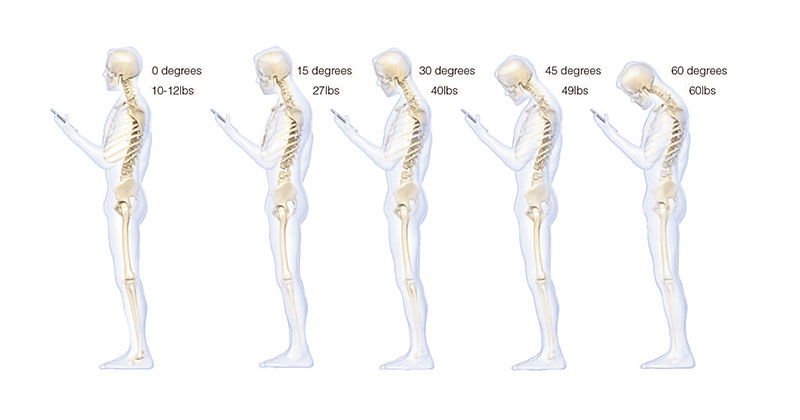 cell phone use spine Dr. Hansraj study