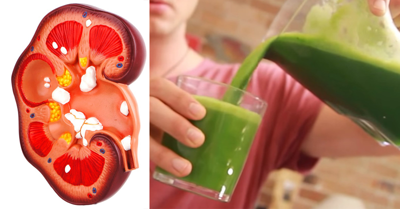 kidney detox drink FI