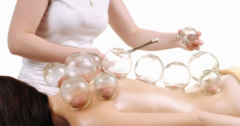 cupping therapy FI