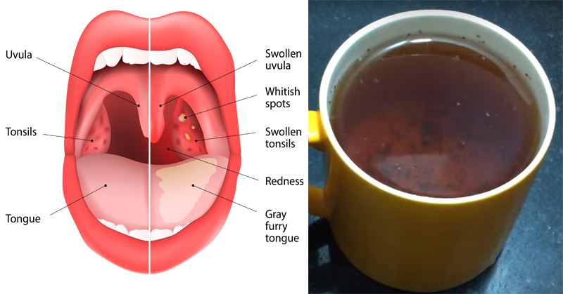 oregano tea infections FI