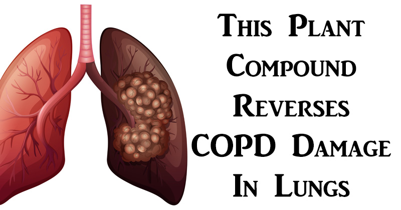 COPD damage FI