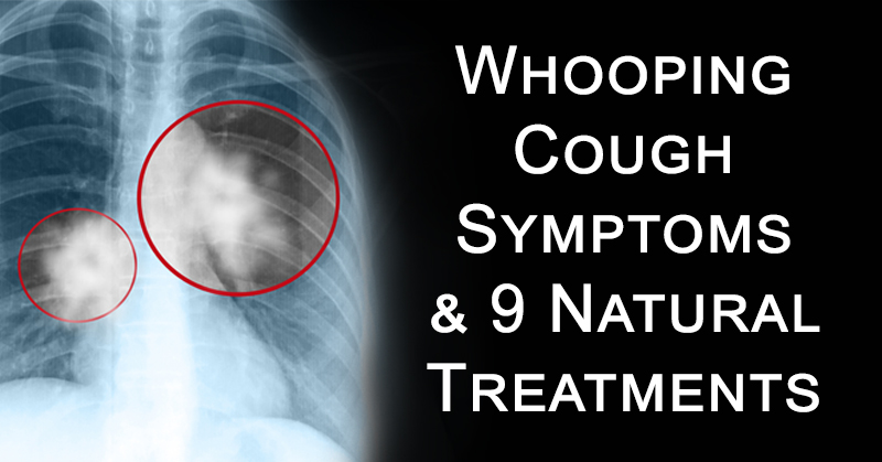whooping cough FI02