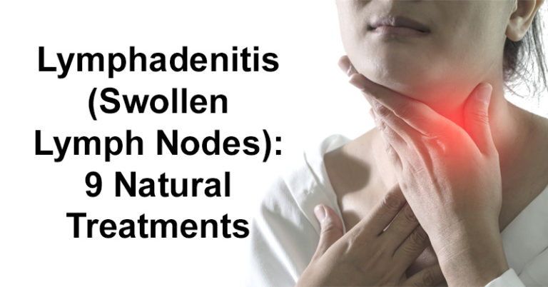 swollen lymph nodes back of neck treatment
