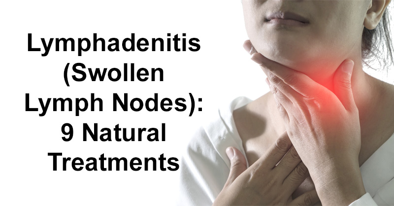 Lymphadenitis (Swollen Lymph Nodes): 9 Natural Treatments - David ...