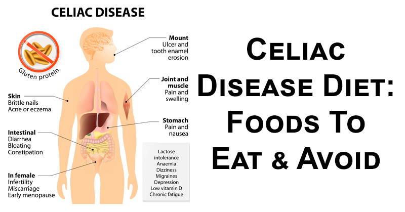 celiac disease FI
