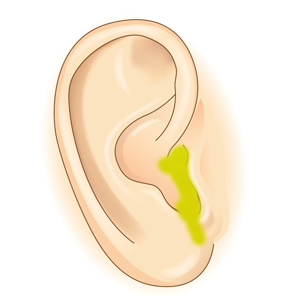 earwax health