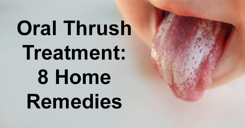 mouth thrush treatment