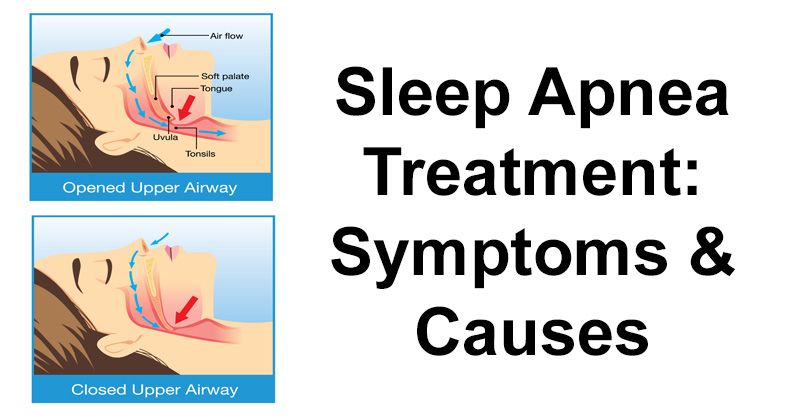 sleep apnea treatment FI