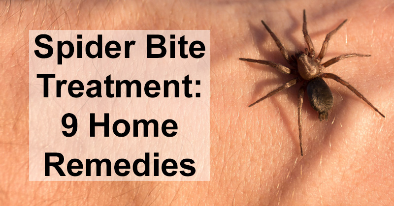5 Home remedies for spider bites to get rid of it