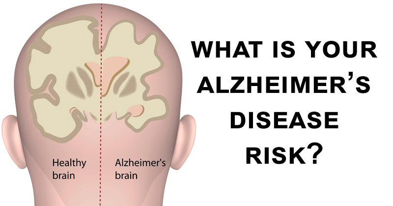 Alzheimer's disease risk FI