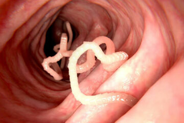 tapeworms FI