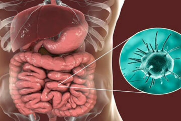 stomach parasites FI