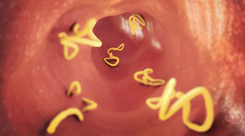 stomach parasites tapeworm