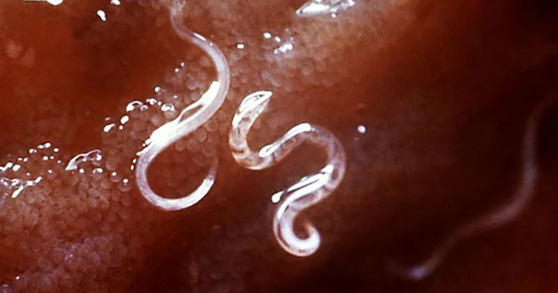 get rid of parasites hookworm